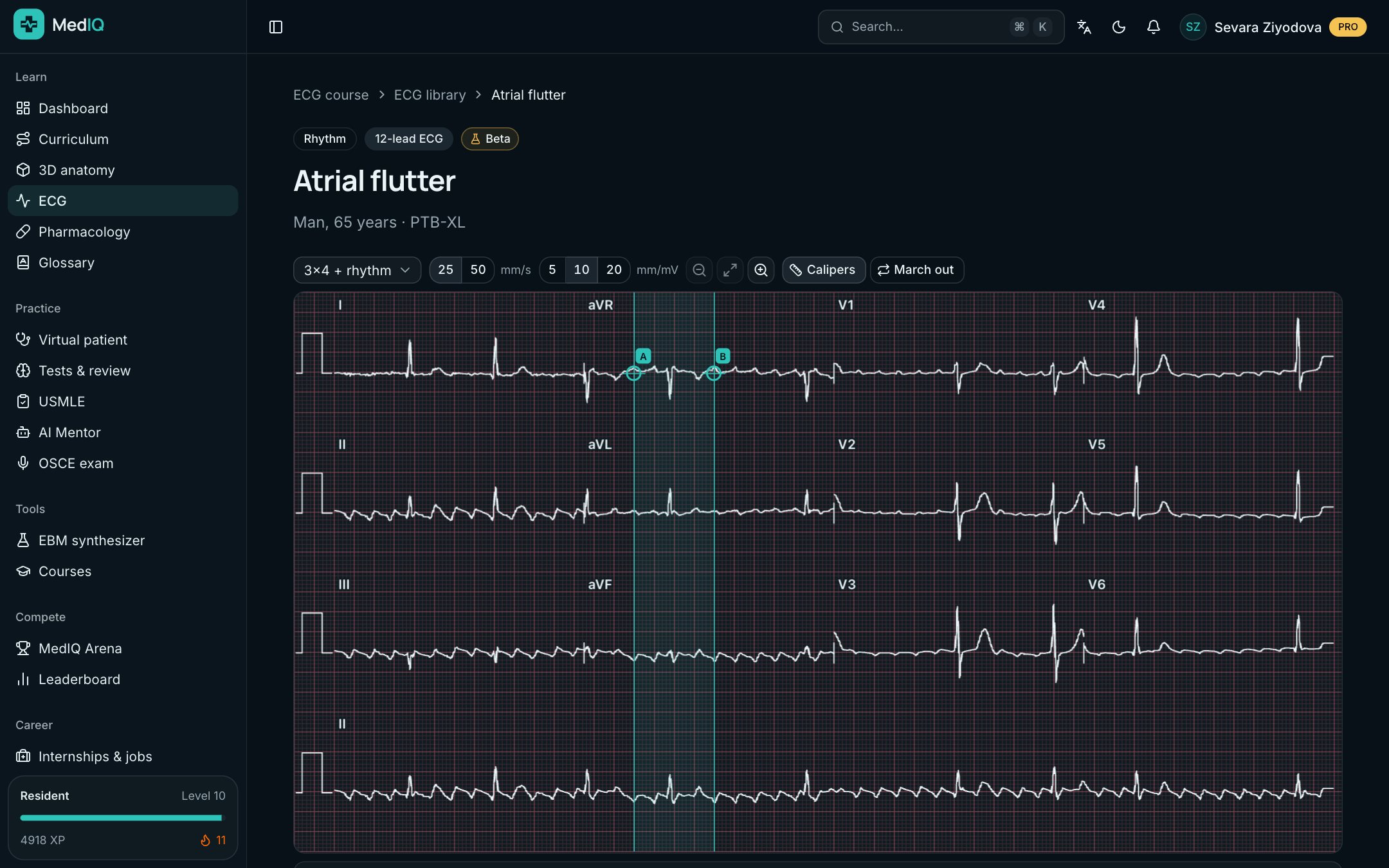 12-lead ECG: a screen of the MedIQ ECG course