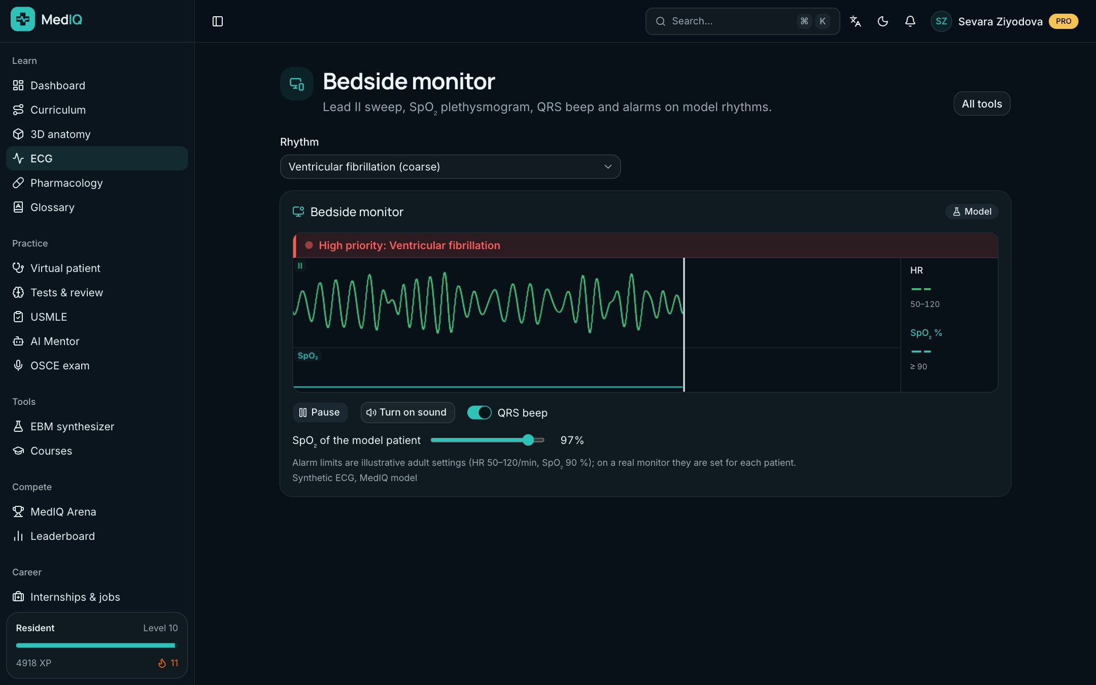 Bedside monitor: a screen of the MedIQ ECG course