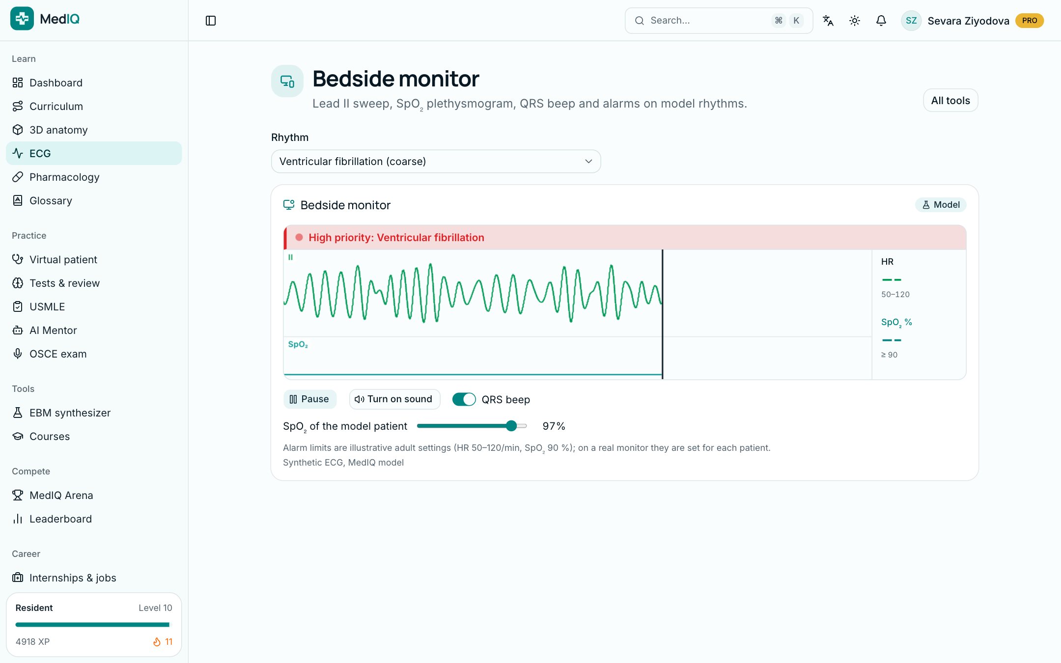 Bedside monitor: a screen of the MedIQ ECG course