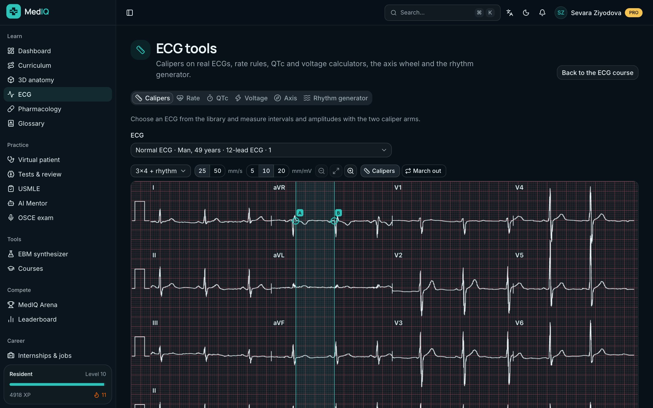 ECG tools: a screen of the MedIQ ECG course