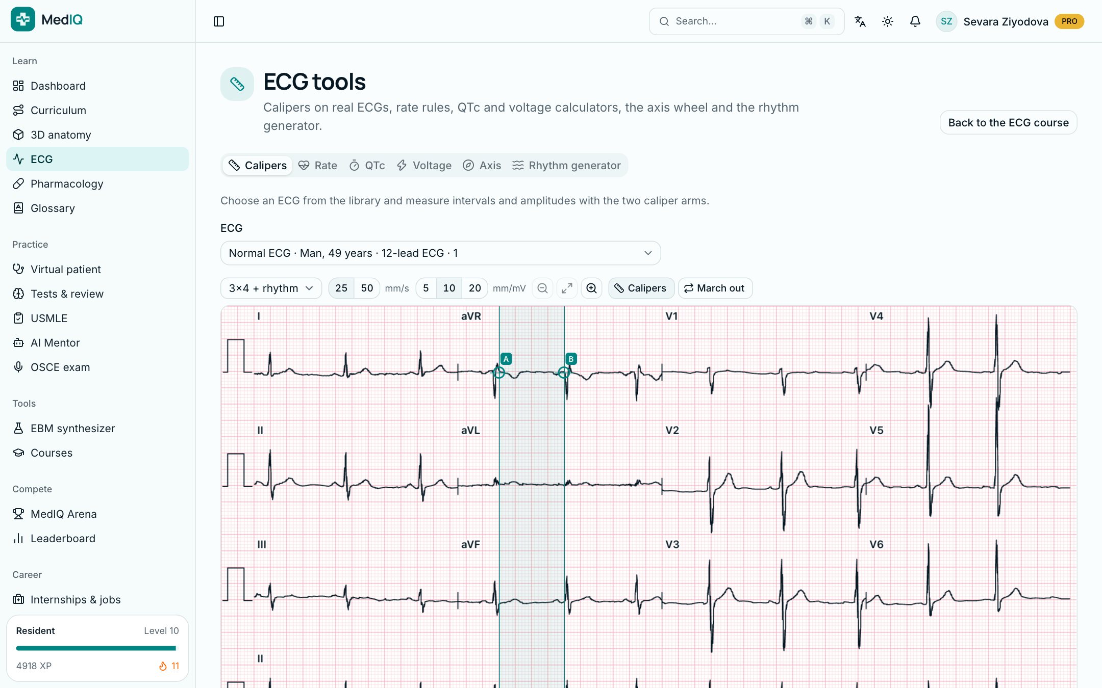 ECG tools: a screen of the MedIQ ECG course