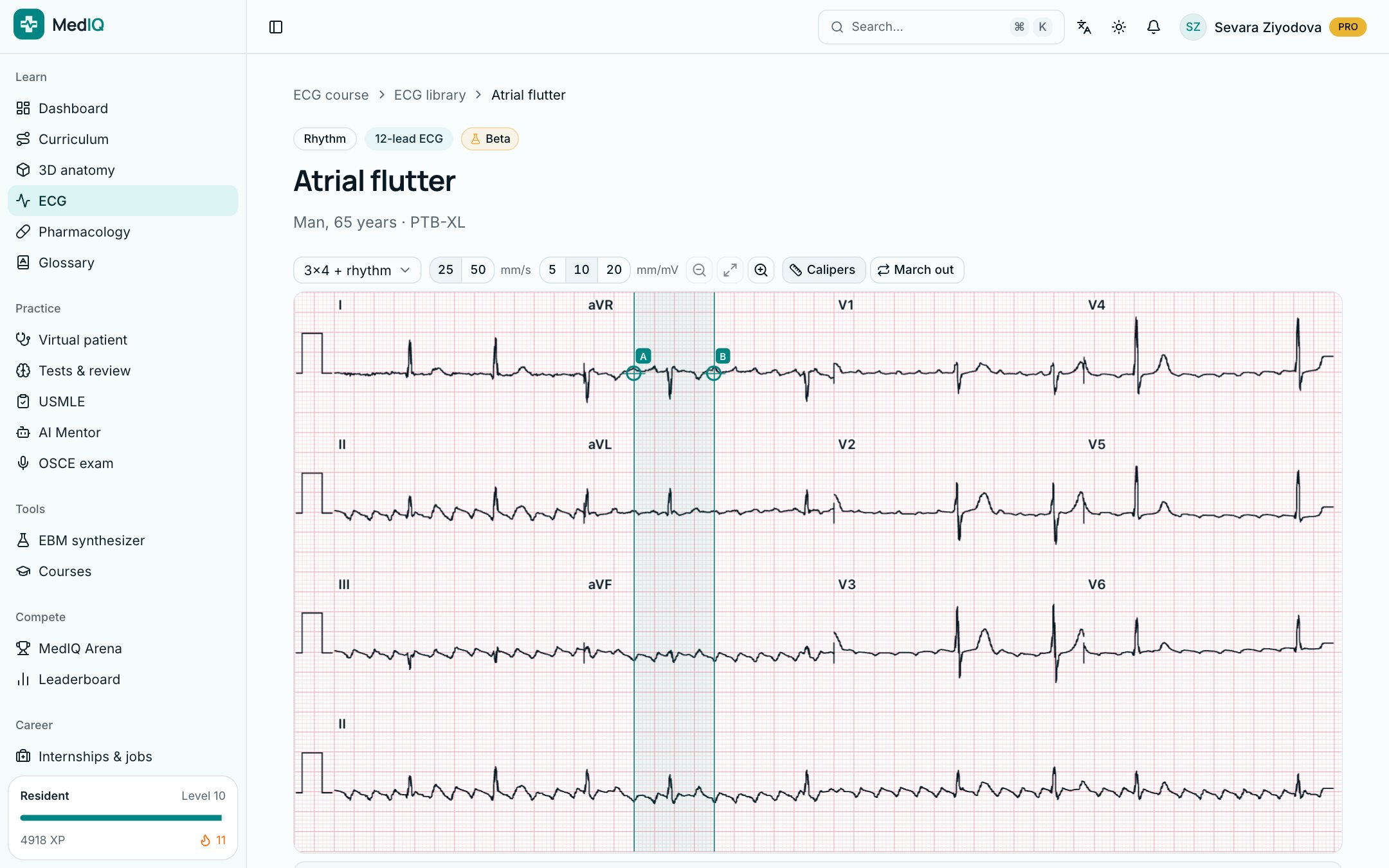 12-lead ECG: a screen of the MedIQ ECG course