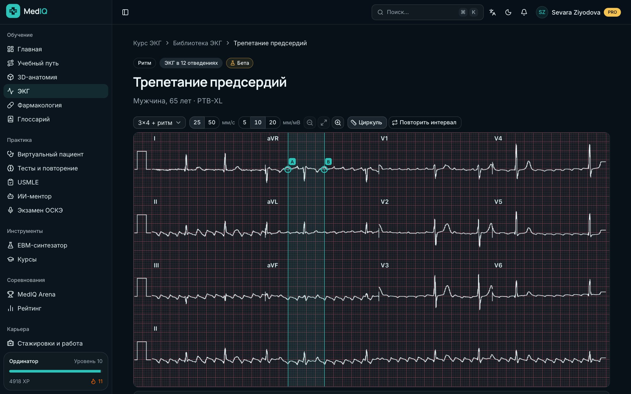 ЭКГ в 12 отведениях — экран курса ЭКГ MedIQ