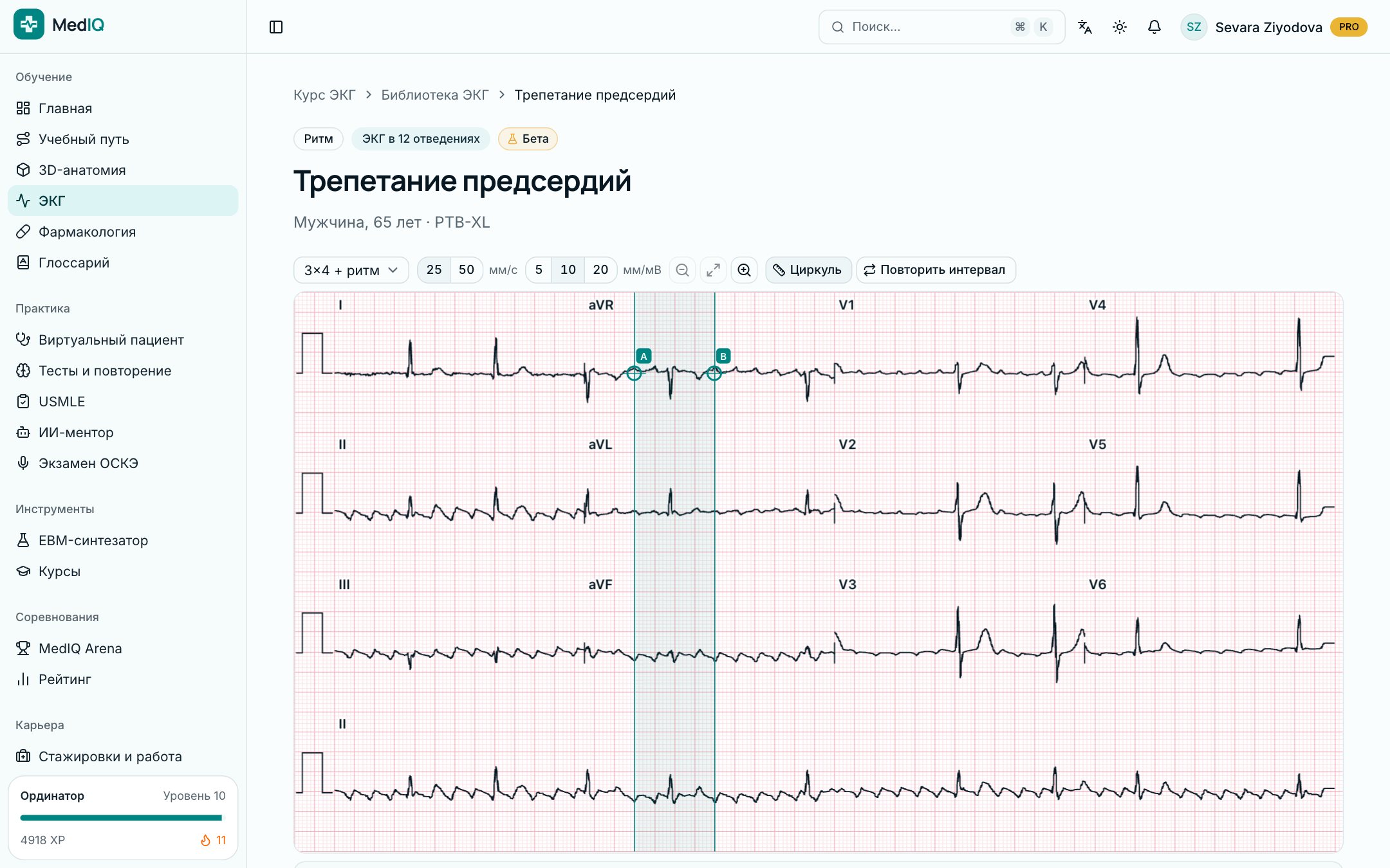 ЭКГ в 12 отведениях — экран курса ЭКГ MedIQ