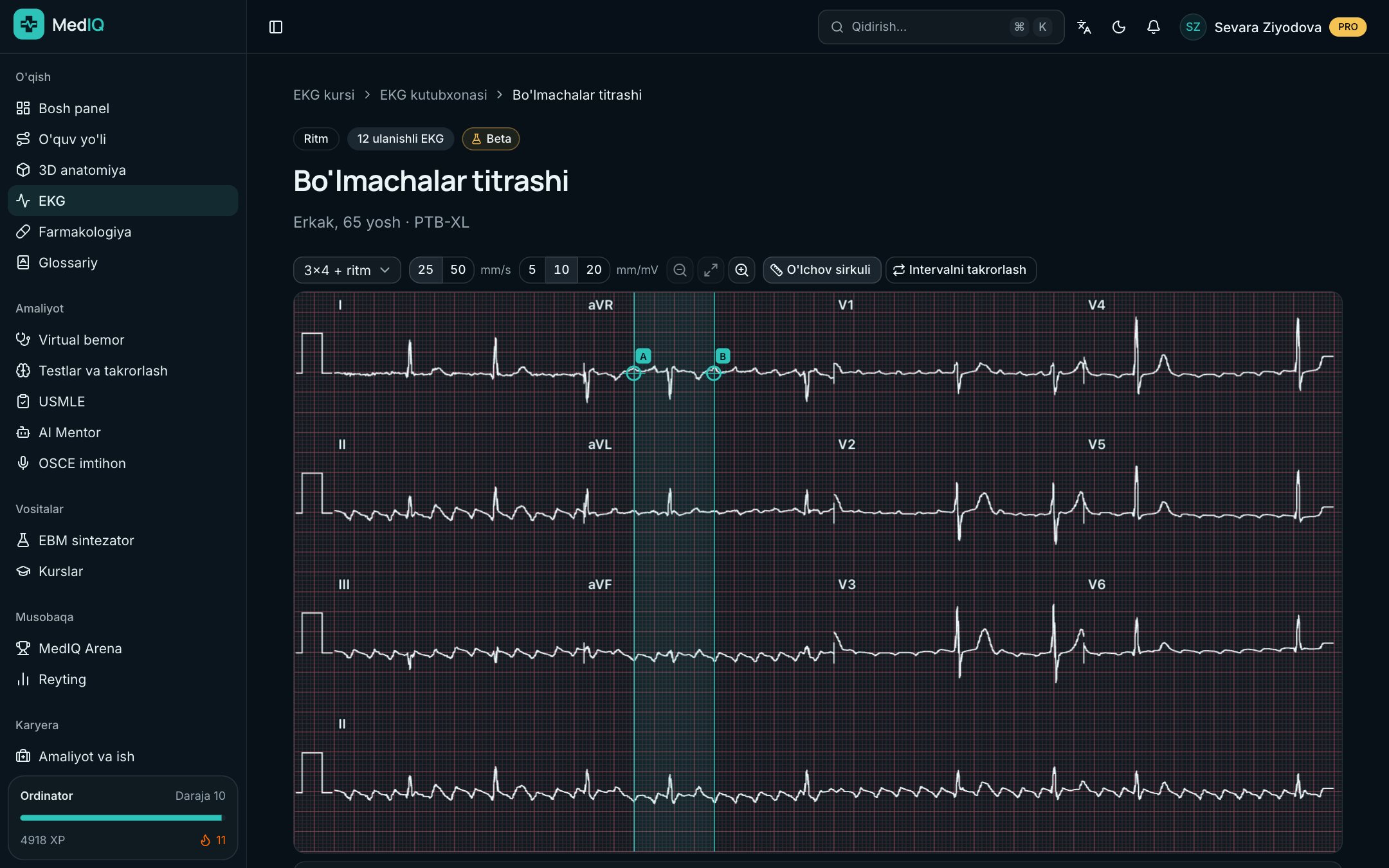12 ulanishli EKG — MedIQ EKG kursi ekrani