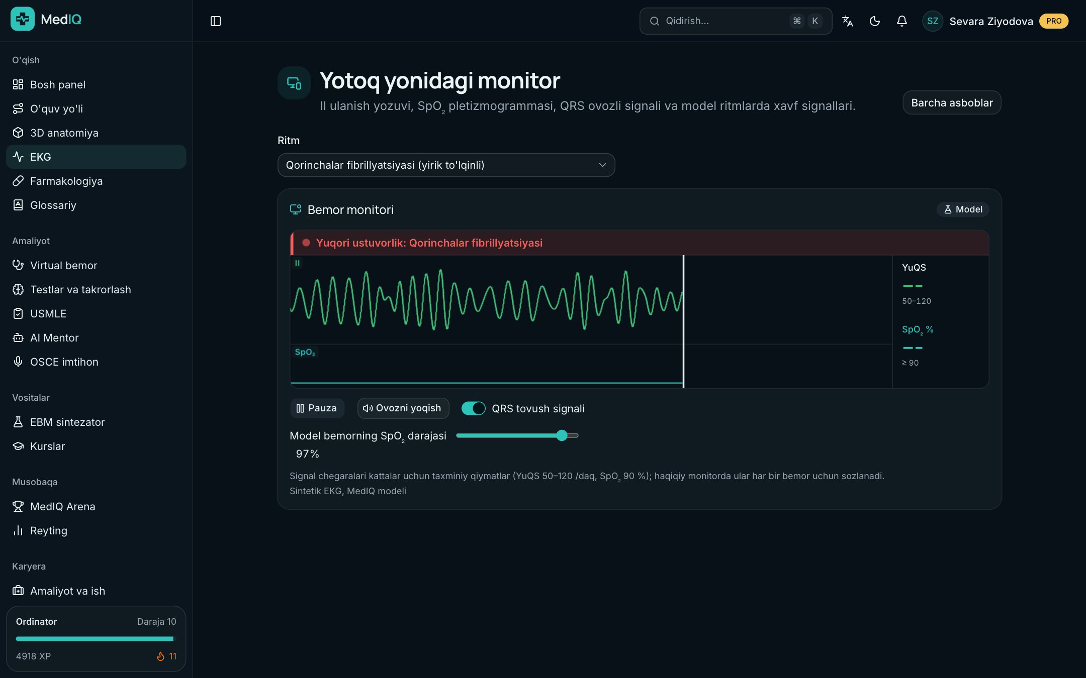 Yotoq yonidagi monitor — MedIQ EKG kursi ekrani