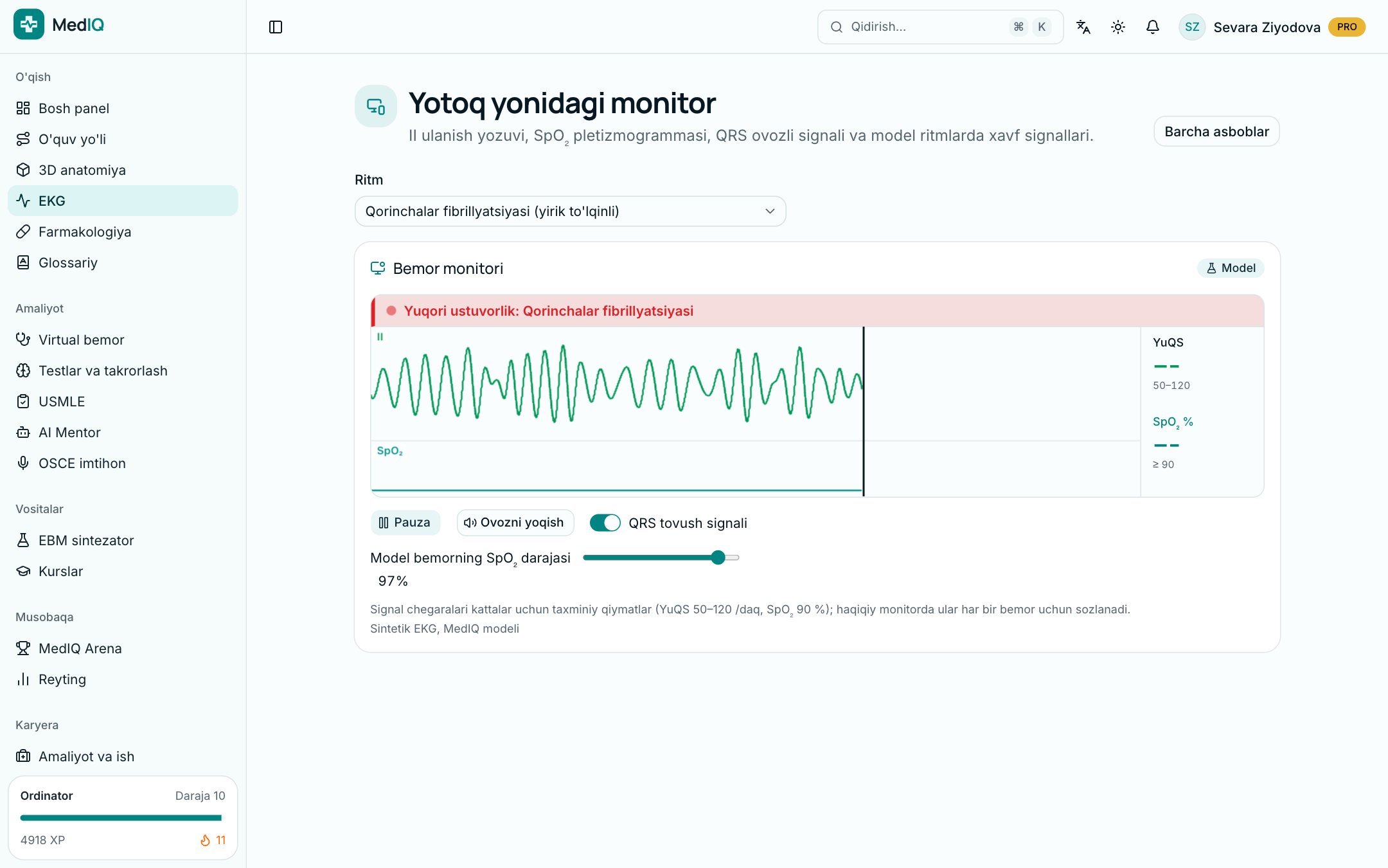 Yotoq yonidagi monitor — MedIQ EKG kursi ekrani