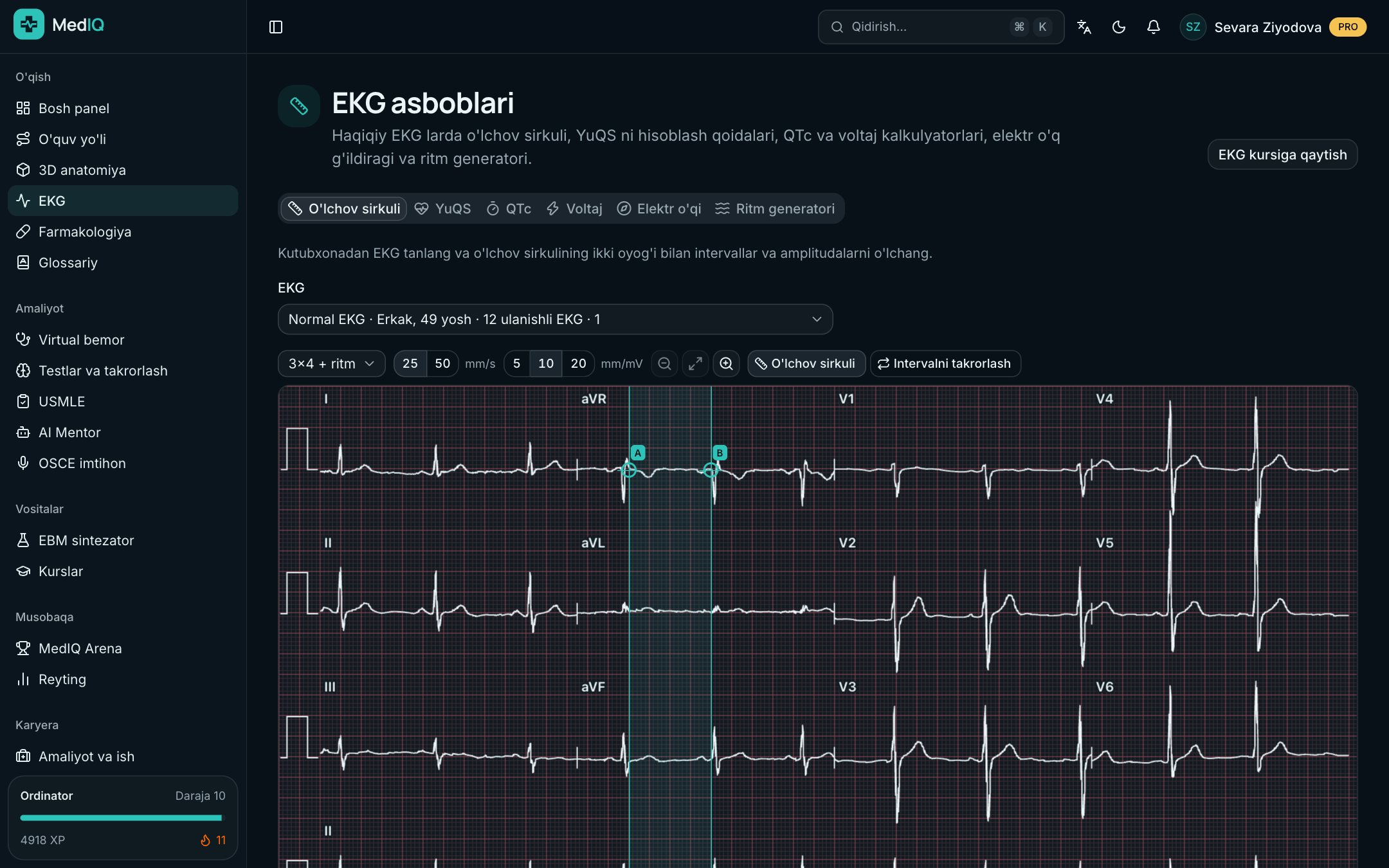 EKG asboblari — MedIQ EKG kursi ekrani
