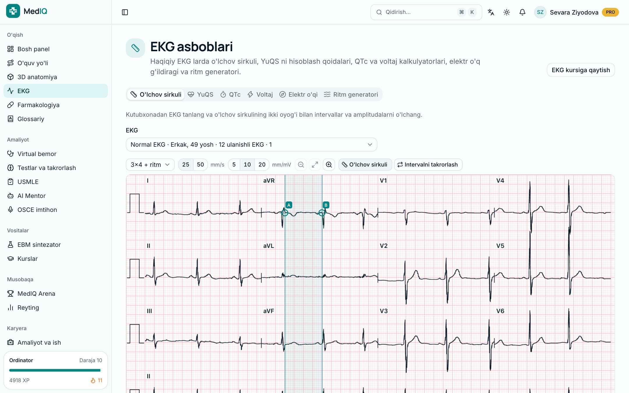 EKG asboblari — MedIQ EKG kursi ekrani