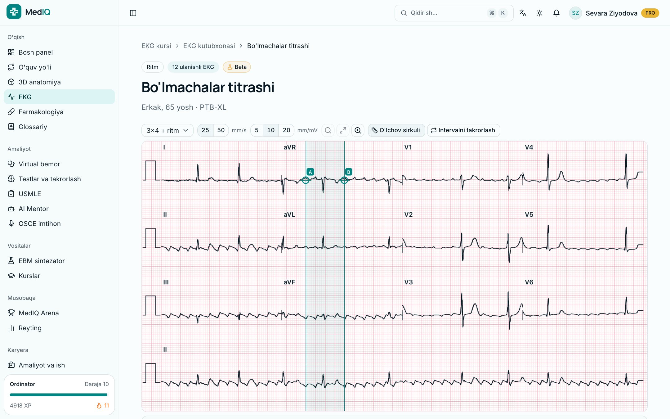 12 ulanishli EKG — MedIQ EKG kursi ekrani