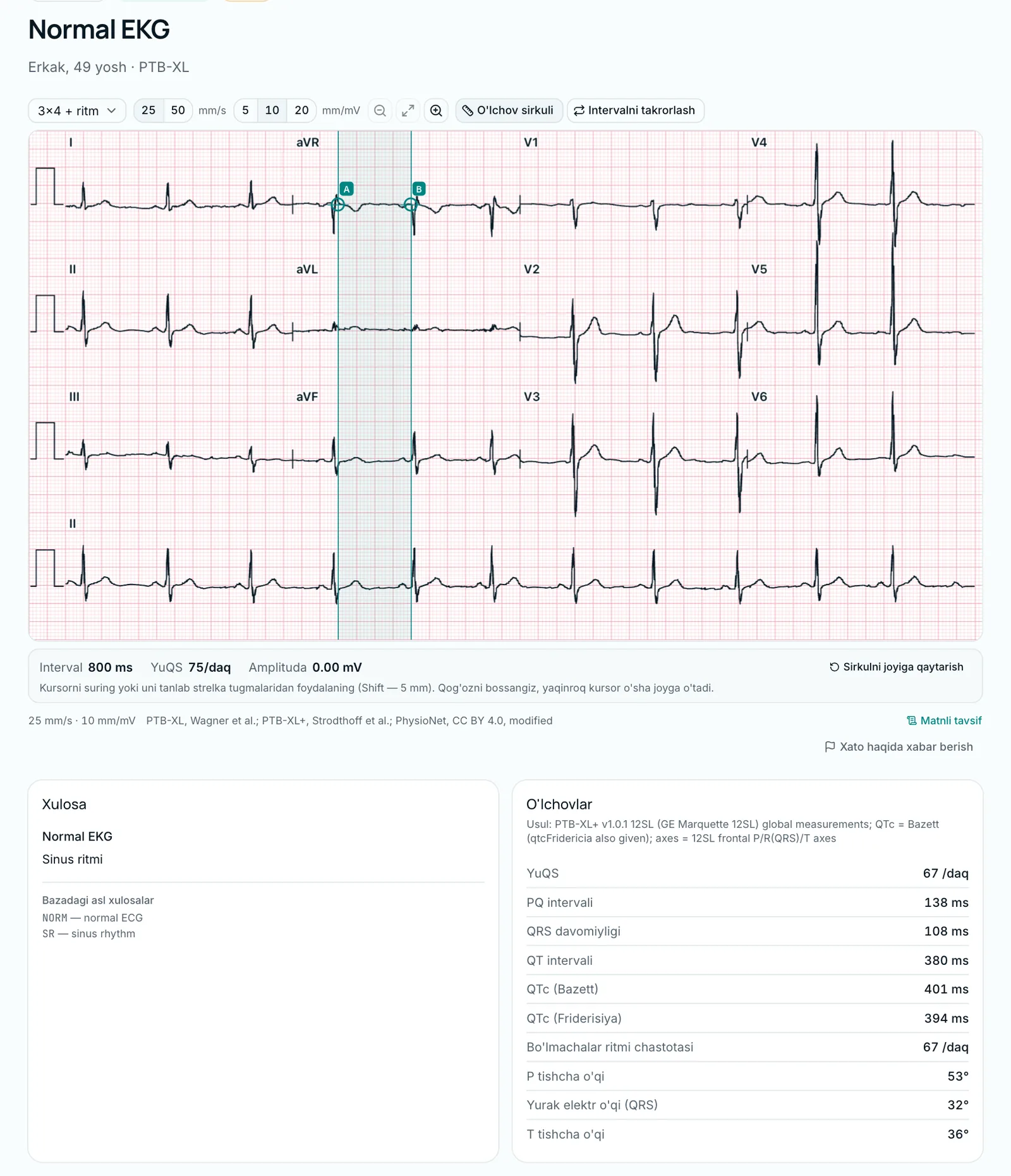 Kutubxonadagi normal 12 ulanishli EKG va o'lchovlar kartasi