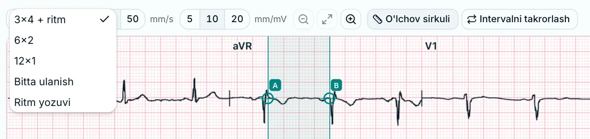 EKG ko'ruvchisining asboblar paneli, "Joylashuv" ro'yxati ochiq