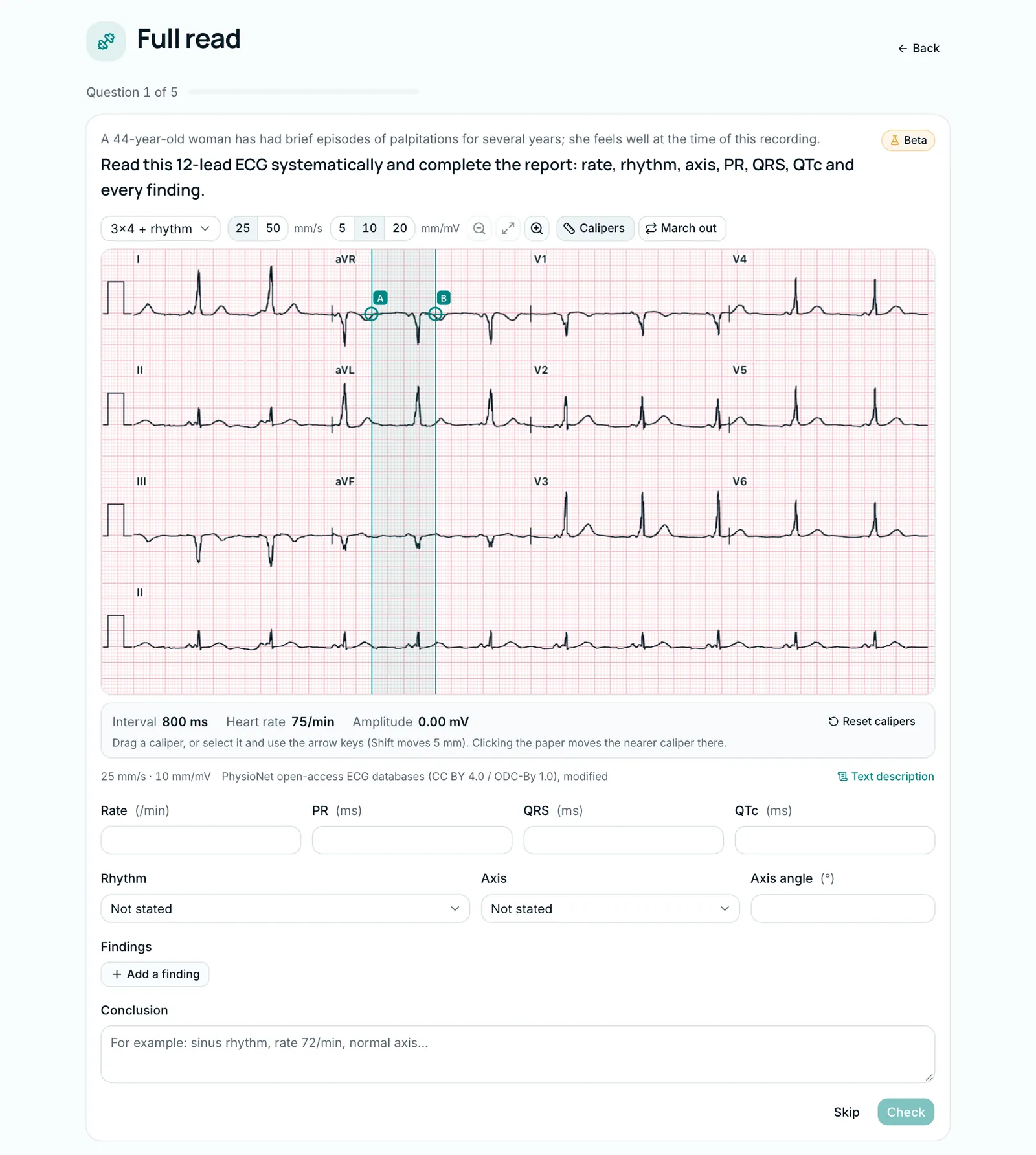 Full read drill: a 12-lead ECG and the empty report form